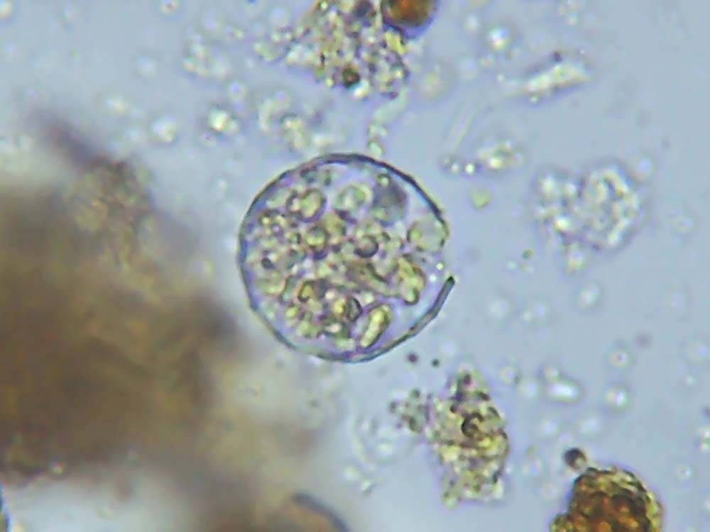 Ameba consuming bacteria