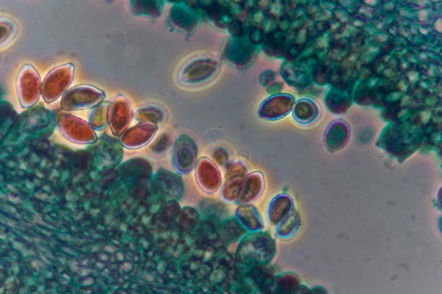 Coprinus comatus spores